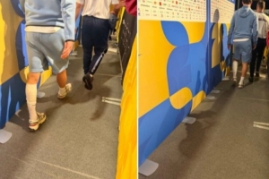 赖斯赛后跛行通过混合采访区，左小腿绑着绷带